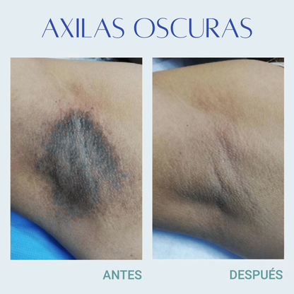 Jelly Booster Aceite Anti-Manchas y Pigmentacion