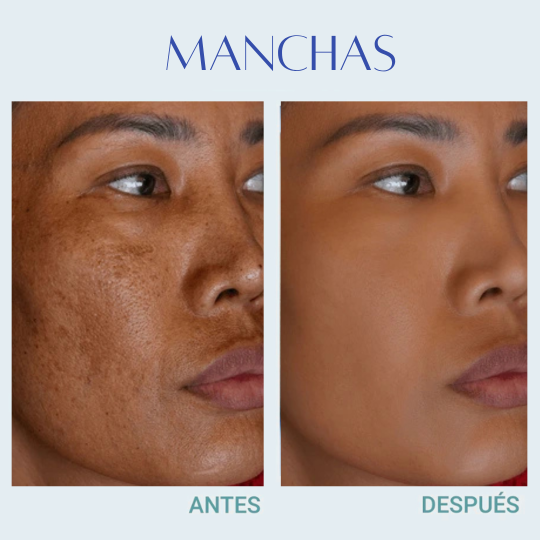 Jelly Booster Aceite Anti-Manchas y Pigmentacion